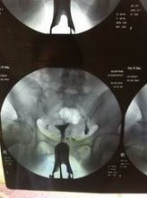 2026南昌三代试管怀孕生孩子医院以及价格