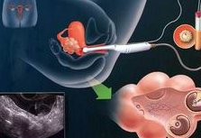 2026年上海市三代试管怀孕生子收费价目表明细公布