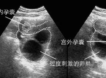 2026天津试管婴儿机构名录全面汇总